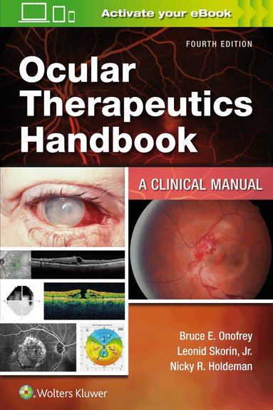Bruce E. Onofrey, Leonid Skorin Jr., Nicky R. Holdeman - Ocular Therapeutics Handbook, Häftad