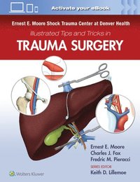 bokomslag Ernest E. Moore Shock Trauma Center at Denver Health Illustrated Tips and Tricks in Trauma Surgery