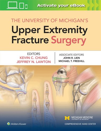 Kevin C Chung - University of Michigan's Upper Extremity Fracture Surgery, Inbunden