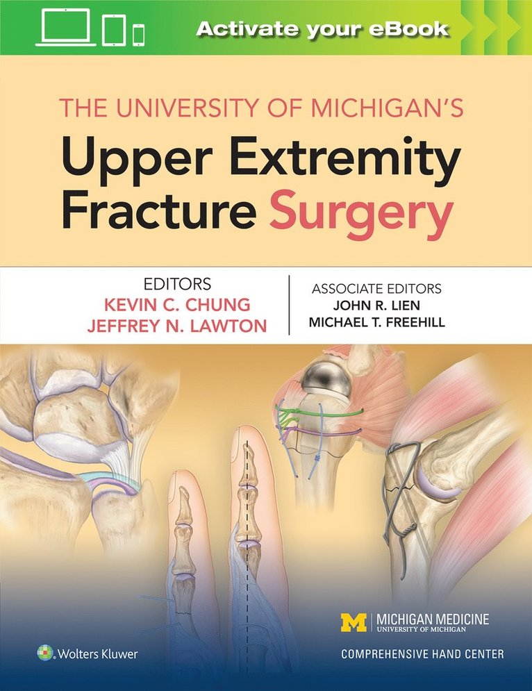 Kevin C Chung, MS Chung, Kevin C, MD, Kevin C. Chung - University of Michigan's Upper Extremity Fracture Surgery, Inbunden