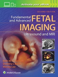 bokomslag Fundamental and Advanced Fetal Imaging Ultrasound and MRI