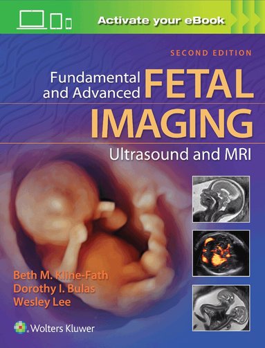 Beth Kline-Fath, Dorothy Bulas, Wesley Lee - Fundamental and Advanced Fetal Imaging Ultrasound and MRI, Inbunden
