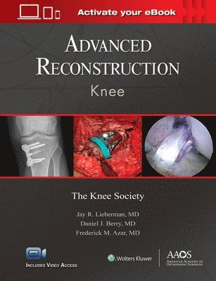 bokomslag Advanced Reconstruction: Knee: Print + Ebook with Multimedia