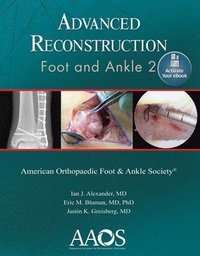 bokomslag Advanced Reconstruction: Foot and Ankle 2: Print + Ebook