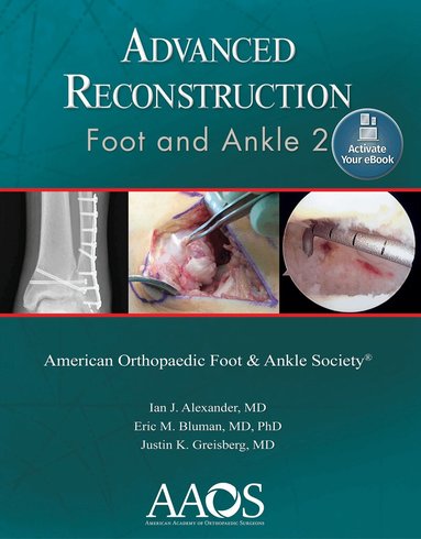 Ian J. Alexander, Eric M. Bluman, Justin K. Greisberg - Advanced Reconstruction: Foot and Ankle 2: Print + Ebook, Häftad