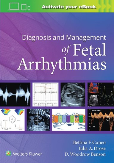 bokomslag Diagnosis and Management of Fetal Arrhythmias