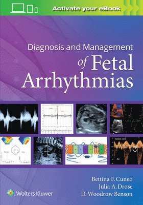 Diagnosis and Management of Fetal Arrhythmias 1