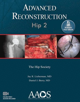 Advanced Reconstruction: Hip 2: Print + Ebook with Multimedia 1