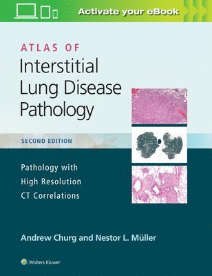 bokomslag Atlas of Interstitial Lung Disease Pathology