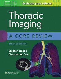 bokomslag Thoracic Imaging: A Core Review