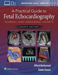 bokomslag A Practical Guide to Fetal Echocardiography