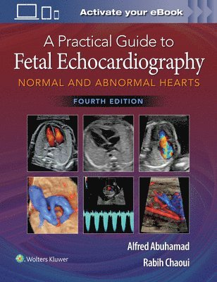A Practical Guide to Fetal Echocardiography 1