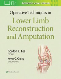 bokomslag Operative Techniques in Lower Limb  Reconstruction and Amputation