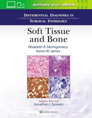 Differential Diagnoses in Surgical Pathology: Soft Tissue and Bone 1