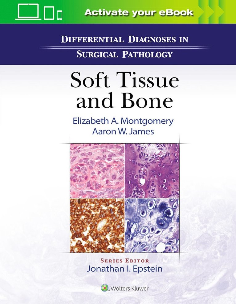 Elizabeth A. Montgomery, Aaron James - Differential Diagnoses in Surgical Pathology: Soft Tissue and Bone, Inbunden