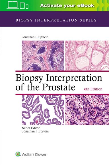 Jonathan I. Epstein - Biopsy Interpretation of the Prostate, Inbunden