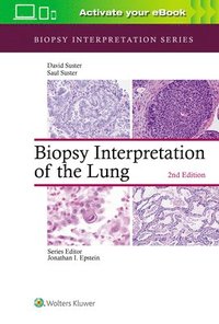 bokomslag Biopsy Interpretation of the Lung