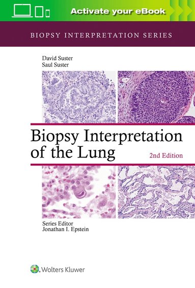 Saul Suster, David Suster - Biopsy Interpretation of the Lung, Inbunden