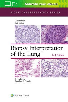 Biopsy Interpretation of the Lung 1
