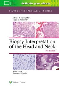 bokomslag Biopsy Interpretation of the Head and Neck