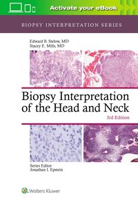 bokomslag Biopsy Interpretation of the Head and Neck