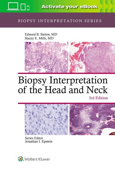 Edward B. Stelow, Stacey Mills - Biopsy Interpretation of the Head and Neck, Inbunden