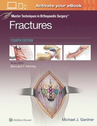 bokomslag Master Techniques in Orthopaedic Surgery: Fractures