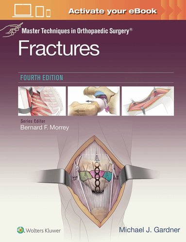 Michael J. Gardner - Master Techniques in Orthopaedic Surgery: Fractures, Inbunden
