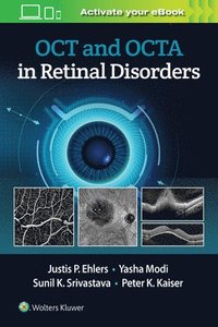 bokomslag OCT and OCTA in Retinal Disorders