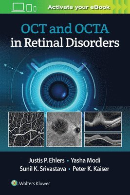 OCT and OCTA in Retinal Disorders 1