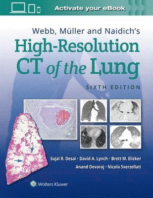 bokomslag Webb, Mller and Naidich's High-Resolution CT of the Lung