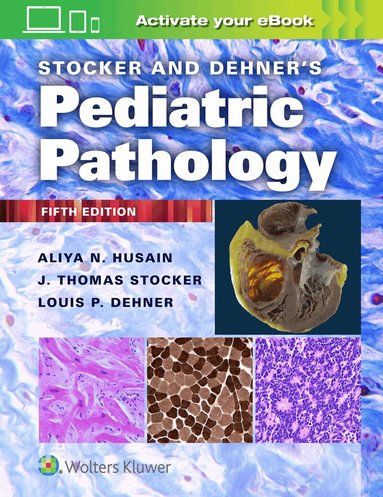 Aliya N. Husain, Louis P. Dehner - Stocker and Dehner's Pediatric Pathology, Inbunden