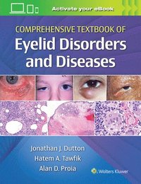 bokomslag Comprehensive Textbook of Eyelid Disorders and Diseases