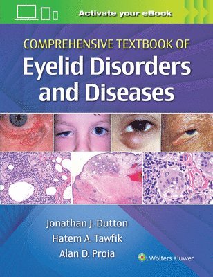 Comprehensive Textbook of Eyelid Disorders and Diseases 1