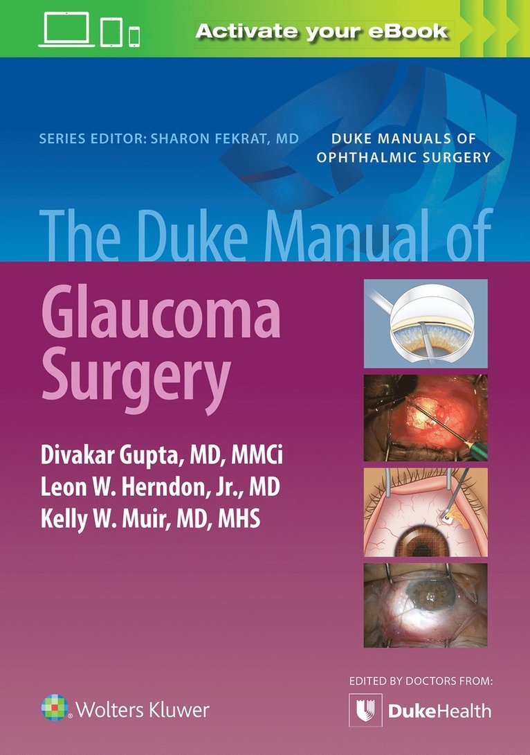 Duke Manual of Glaucoma Surgery 1