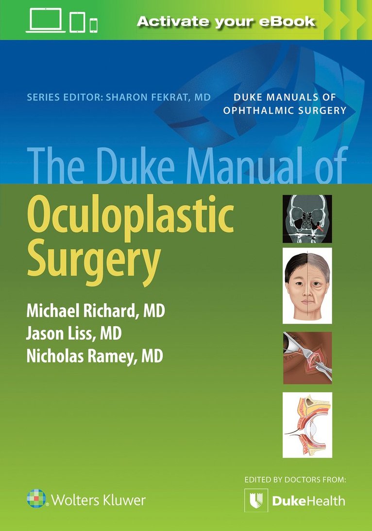 Duke Manual of Oculoplastic Surgery