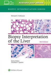 bokomslag Biopsy Interpretation of the Liver