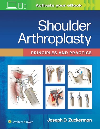 Joseph D. Zuckerman - Shoulder Arthroplasty, Inbunden