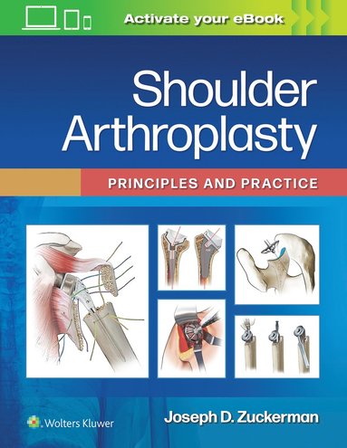 bokomslag Shoulder Arthroplasty