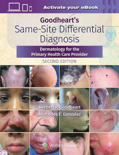 bokomslag Goodheart's Same-Site Differential Diagnosis