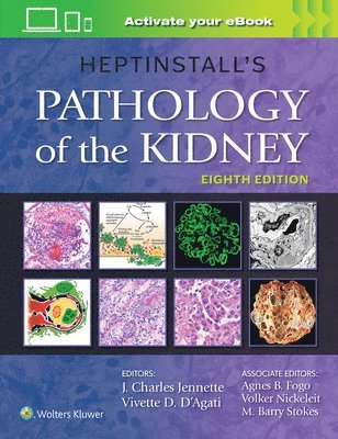 Heptinstall's Pathology of the Kidney 1