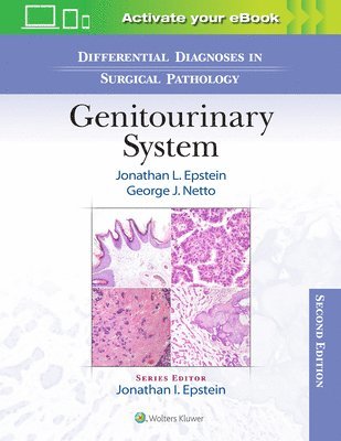 Jonathan Epstein, George J. Netto - Differential Diagnoses in Surgical Pathology: Genitourinary System, Inbunden