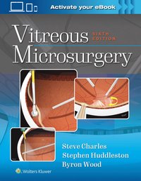 bokomslag Vitreous Microsurgery