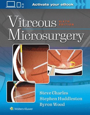 bokomslag Vitreous Microsurgery