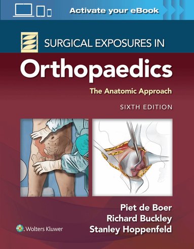 Piet de Boer, Richard Buckley, Stanley Hoppenfeld - Surgical Exposures in Orthopaedics: The Anatomic Approach, Inbunden