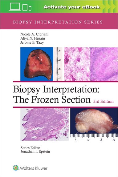 bokomslag Biopsy Interpretation: The Frozen Section: Print + eBook with Multimedia