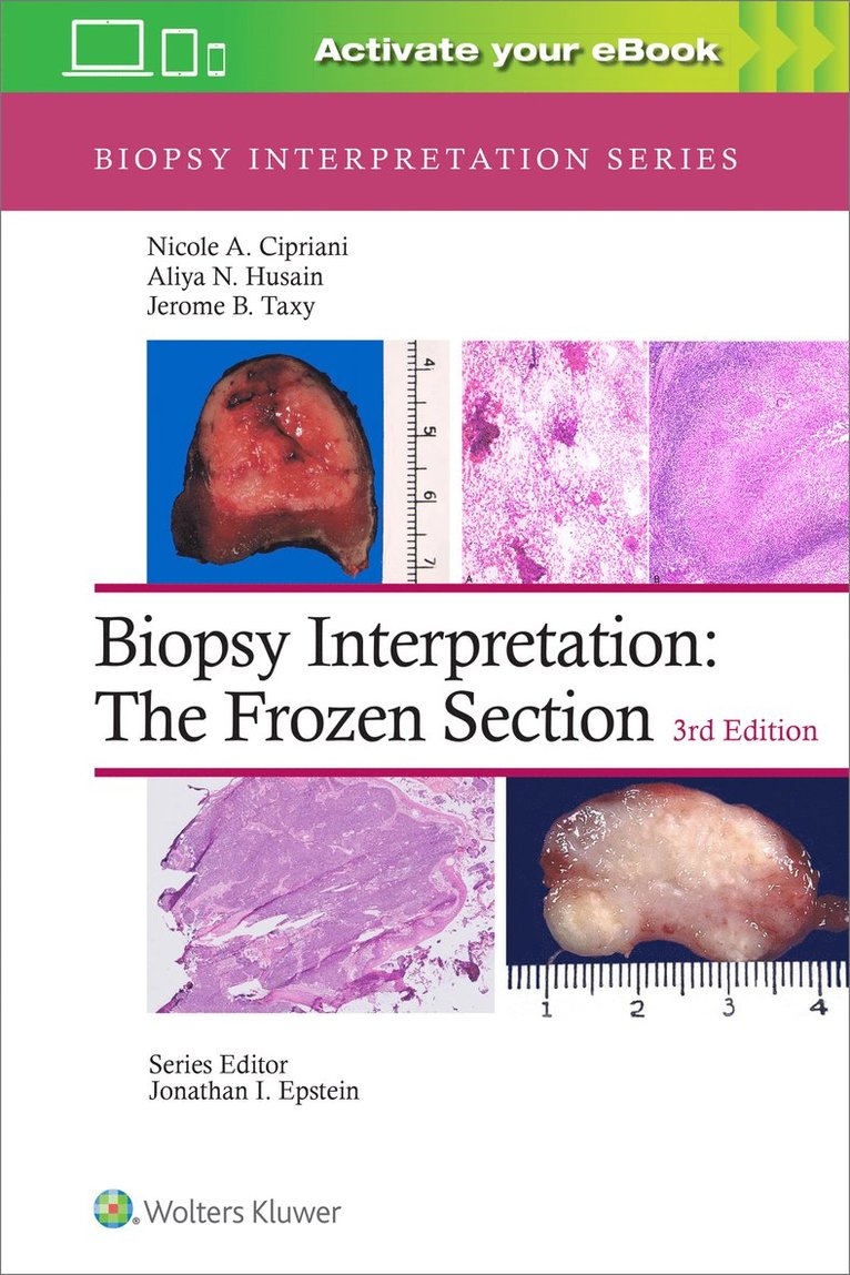 Nicole A. Cipriani, Aliya N. Husain, Jerome B. Taxy, MD Cipriani, Nicole A. - Biopsy Interpretation: The Frozen Section: Print + eBook with Multimedia, Inbunden