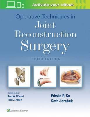 Operative Techniques in Joint Reconstruction Surgery 1