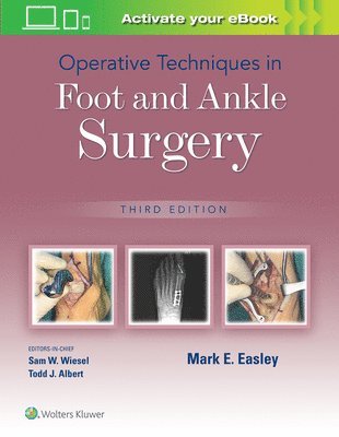 Operative Techniques in Foot and Ankle Surgery 1