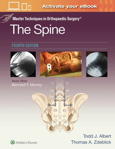 Todd Albert, Thomas A. Zdeblick - Master Techniques in Orthopaedic Surgery: The Spine, Inbunden